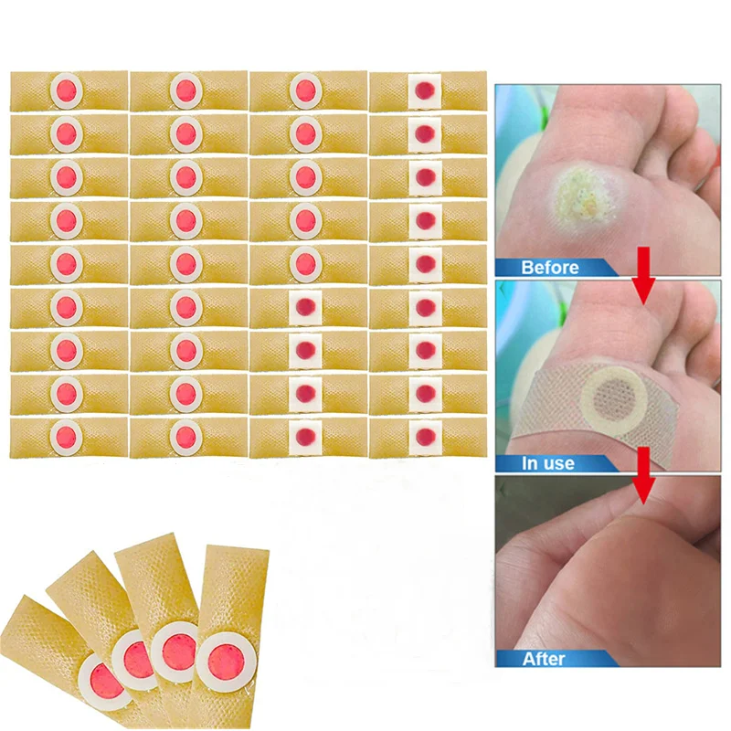 24Pcs Foot Pain Relief Care Stickers Medical Plaster Chicken Eye Corns Patches Warts Thorn Patch Foot Health Care Corn Removal
24Pcs Foot Pain Relief Care Stickers Medical Plaster Chicken Eye Corns Patches Warts Thorn Patch Foot Health Care Corn Removal