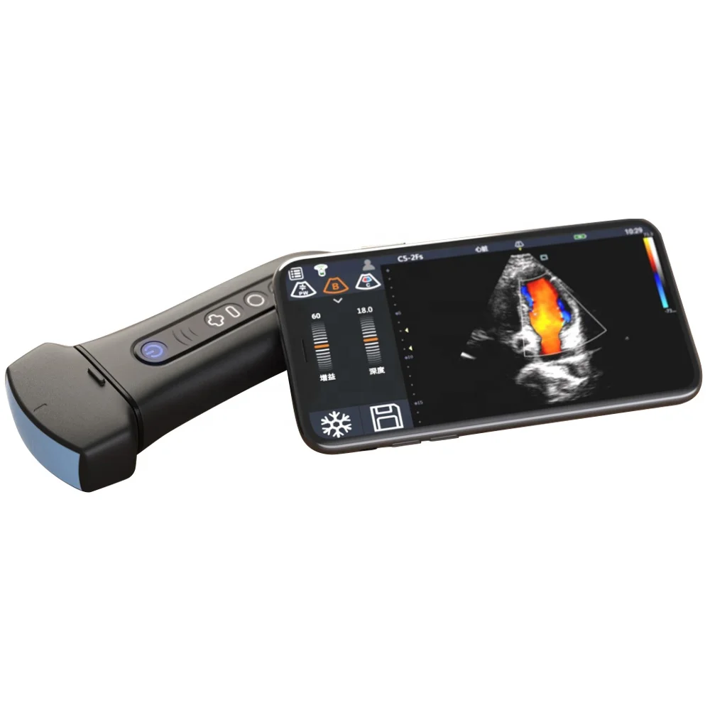 Veterinary Wireless Handheld Diagnostic Color Doppler Ultrasound System Q7Vet
Veterinary Wireless Handheld Diagnostic Color Doppler Ultrasound System Q7Vet