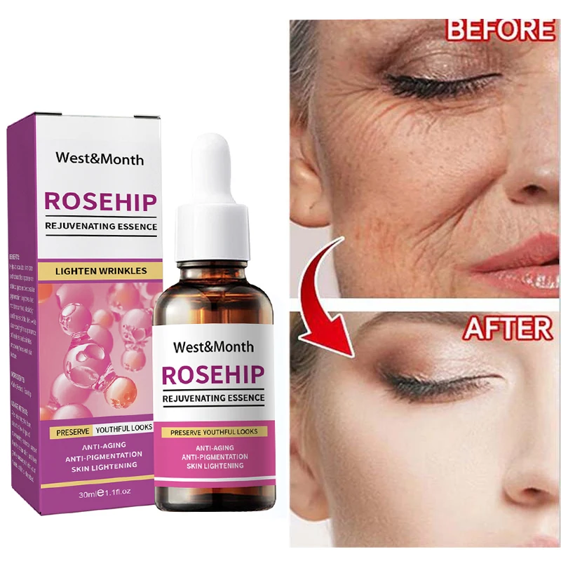

Instant Wrinkle Removal Face Serum Retinol Anti-Aging Lift Firming Fade Fine Lines Essence Freckles Whitening Brighten Skin Care