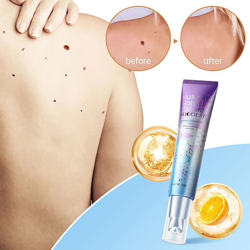 Newest Warts Remover Plantar and Genital Wart HPV Treatment Cream Skin Care Antibacterial Ointment Mole Skin Tag Removal 20g
Newest Warts Remover Plantar and Genital Wart HPV Treatment Cream Skin Care Antibacterial Ointment Mole Skin Tag Removal 20g