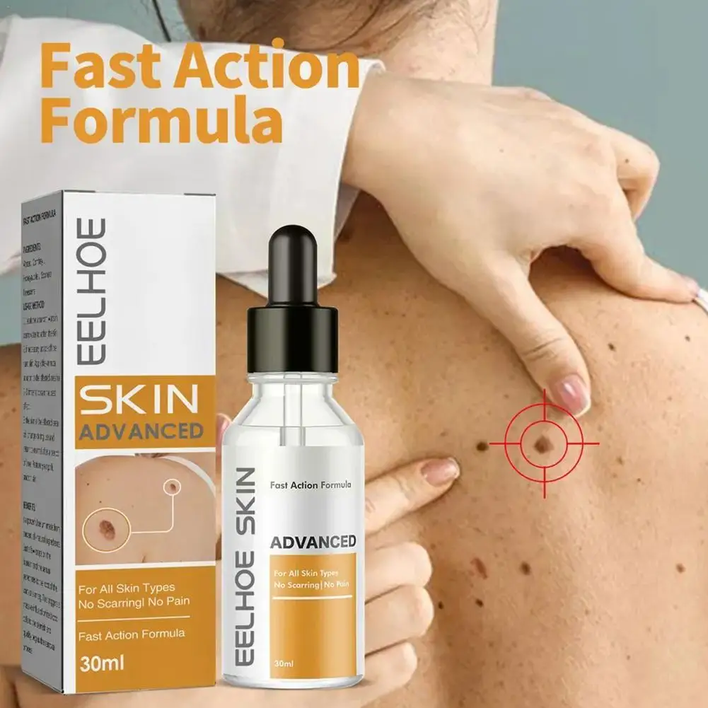 Бородавок и бородавок, средство для безболезненного удаления бородавок, 30 мл
Бородавок и бородавок, средство для безболезненного удаления бородавок, 30 мл