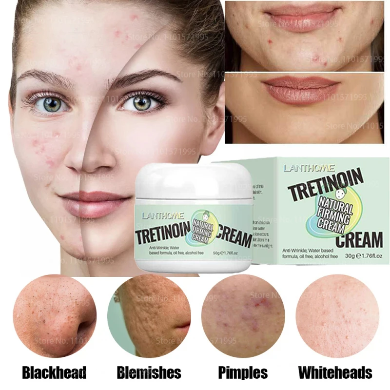 Alicylic Acid Shrink Pores Moisturizing Nourish Whitening Cream Firming Remove Wrinkle Anti-Aging Skin Beauty Health Care
Alicylic Acid Shrink Pores Moisturizing Nourish Whitening Cream Firming Remove Wrinkle Anti-Aging Skin Beauty Health Care