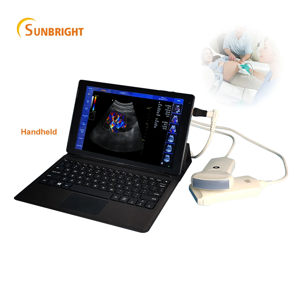 2022 CE Baby Sound Pocket Fetal Pregnancy Handheld Portable Color Doppler Convex Ultrasound
2022 CE Baby Sound Pocket Fetal Pregnancy Handheld Portable Color Doppler Convex Ultrasound