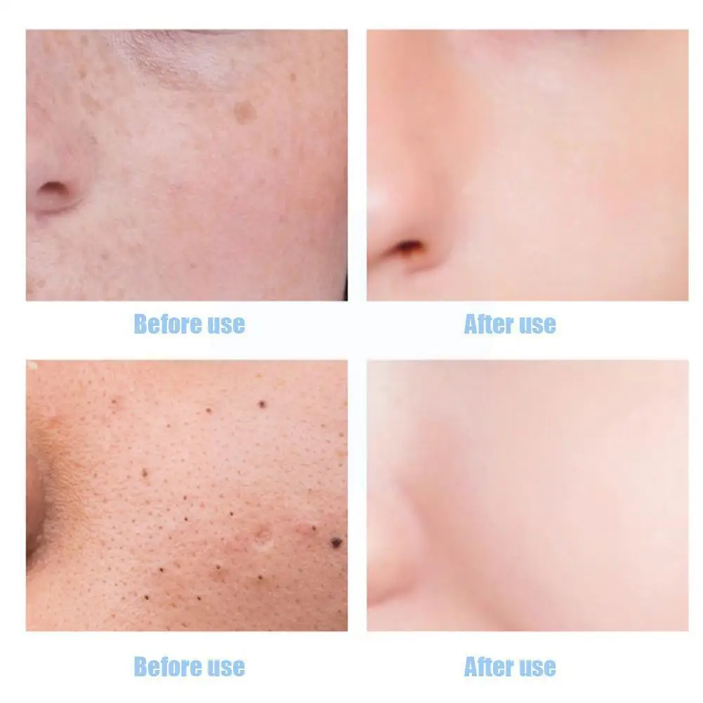 Laikou Collagen Massage Cream Deep Clean Pores Moisturizing 80g Cleansing Cream Lifting Pore Balance Face Exfoliate Deep U0v2 
Laikou Collagen Massage Cream Deep Clean Pores Moisturizing 80g Cleansing Cream Lifting Pore Balance Face Exfoliate Deep U0v2