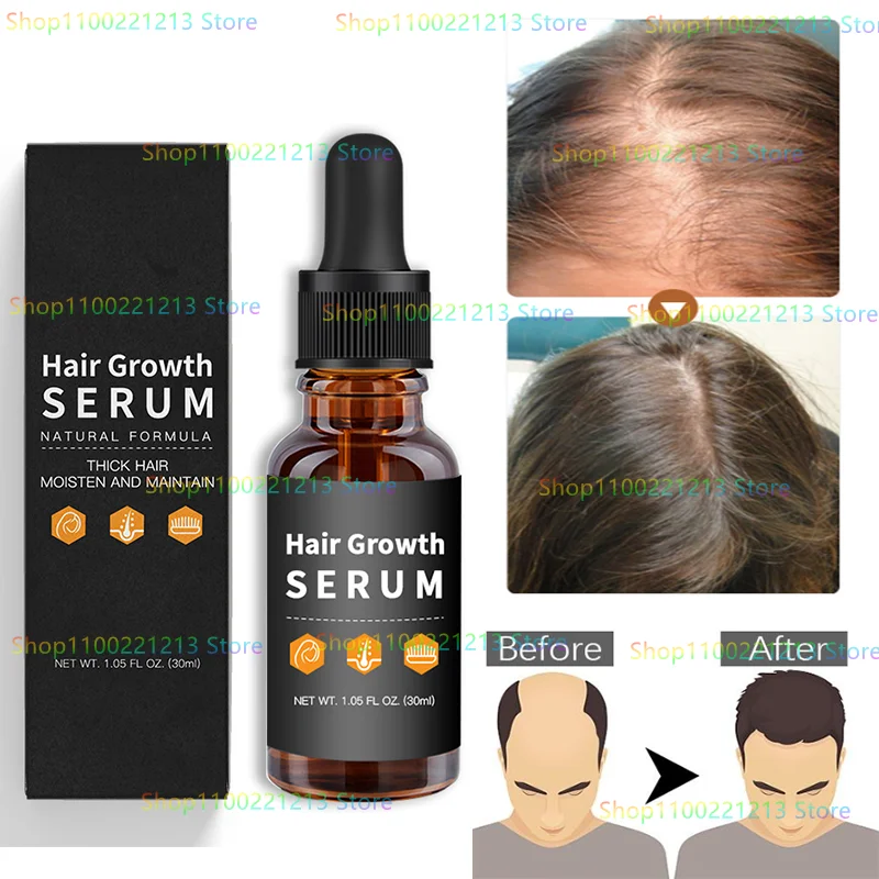 Hair Growth SERUM Hair Growth SERUM Hair Growth SERUM Fast and Effective Hair Growth and Hair Loss Prevention Hair Care
Hair Growth SERUM Hair Growth SERUM Hair Growth SERUM Fast and Effective Hair Growth and Hair Loss Prevention Hair Care