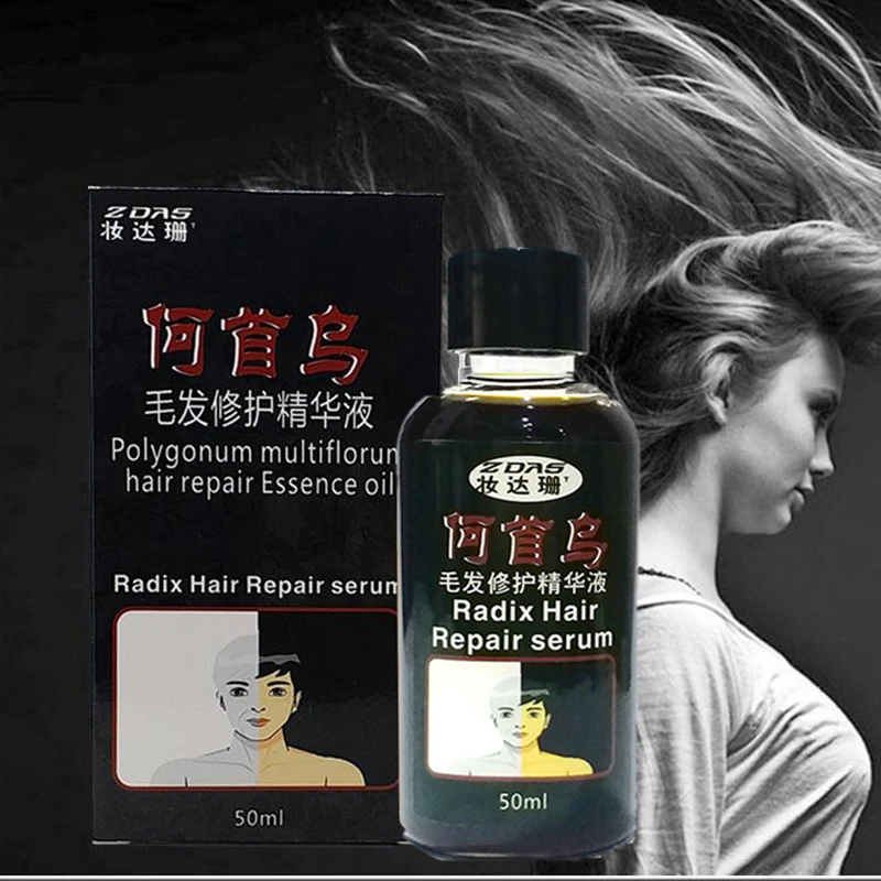 1pcs 50ml traditional Chinese medicine cure white hair turn gray black liquid juvenile loss care oil Treatment Hair Loss Product
1pcs 50ml traditional Chinese medicine cure white hair turn gray black liquid juvenile loss care oil Treatment Hair Loss Product