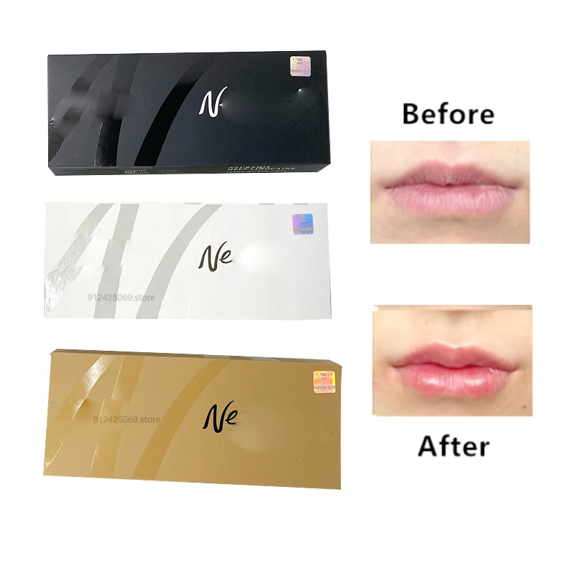 Neuramis 1pcs 1ml Face, chest, buttocks, nose, chin ,Lip FOR Hyaluronic Acid Moisturizing Balm BB cream LIp Cream hyaluron pen
Neuramis 1pcs 1ml Face, chest, buttocks, nose, chin ,Lip FOR Hyaluronic Acid Moisturizing Balm BB cream LIp Cream hyaluron pen