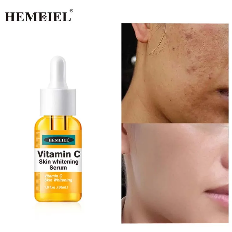 Vitamin C Whitening Facial Serum Hyaluronic Acid Moisturizing Brightening Skin Care Products Dark Spot Remove Beauty Cosmetics
Vitamin C Whitening Facial Serum Hyaluronic Acid Moisturizing Brightening Skin Care Products Dark Spot Remove Beauty Cosmetics