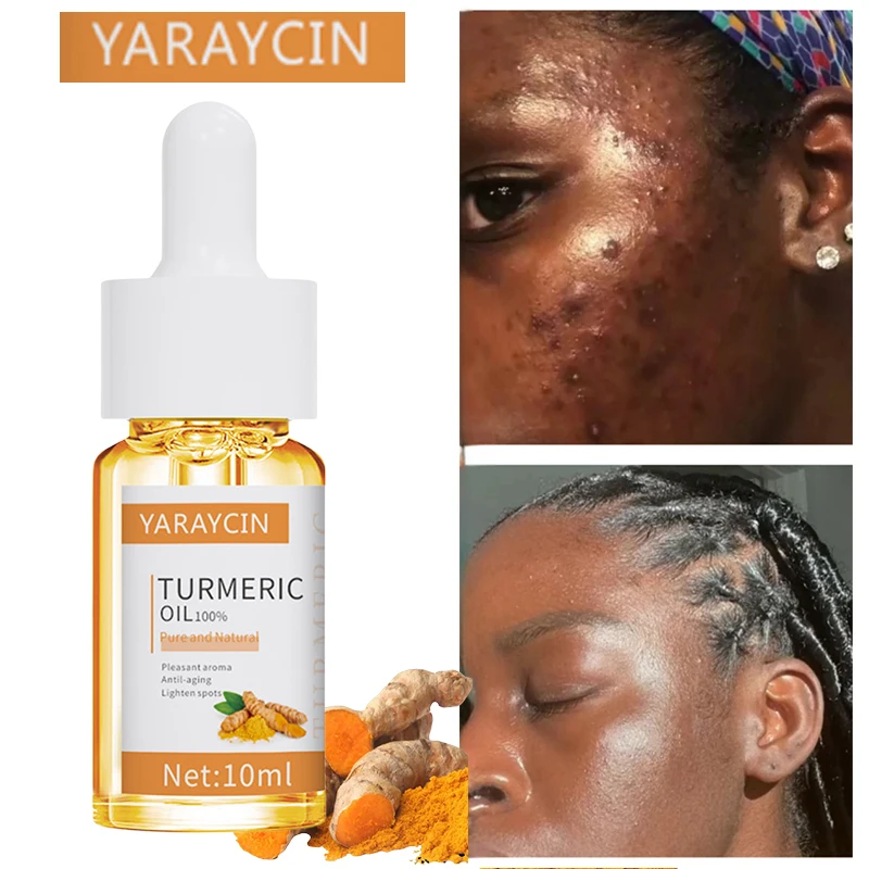 Turmeric Oil Facial Serum Freckles Dark Spot Blemish Freckles Remover Anti Aging Whitening Moisturizer Korean Skin Care Products
Turmeric Oil Facial Serum Freckles Dark Spot Blemish Freckles Remover Anti Aging Whitening Moisturizer Korean Skin Care Products