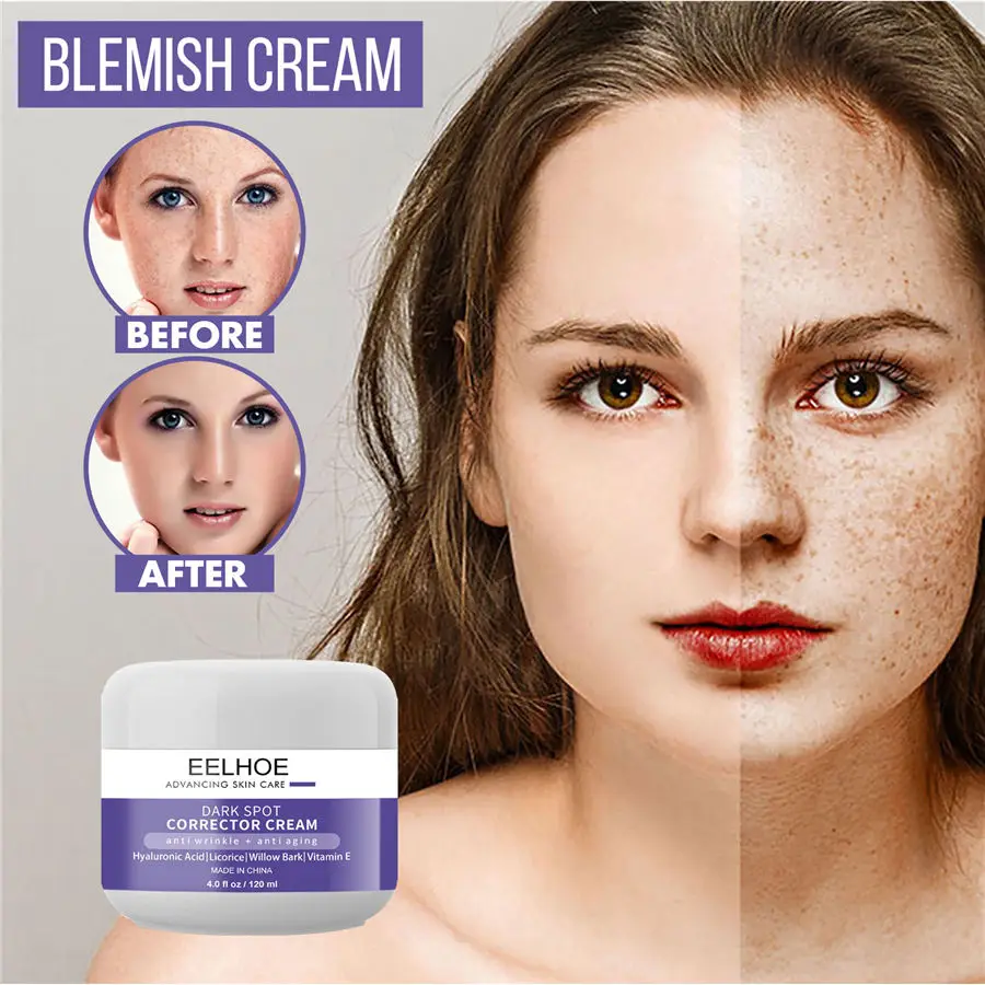 Effective Anti Wrinkle Whitening Cream Freckle Remove Melasma Acne Spot Pigment Melanin Dark Spots Pigmentation Gel Skin Care 
Effective Anti Wrinkle Whitening Cream Freckle Remove Melasma Acne Spot Pigment Melanin Dark Spots Pigmentation Gel Skin Care