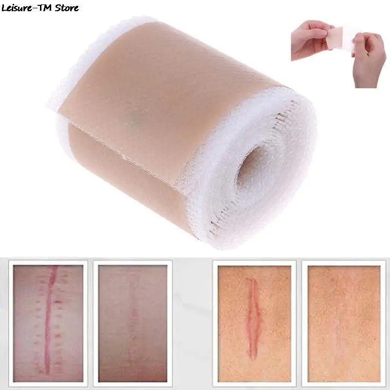 4x150cm/3.5x12cm Efficient Surgery Scar Removal Silicone Gel Sheet Therapy Patch for Acne Trauma Burn Scar Skin Repair Treatment
4x150cm/3.5x12cm Efficient Surgery Scar Removal Silicone Gel Sheet Therapy Patch for Acne Trauma Burn Scar Skin Repair Treatment