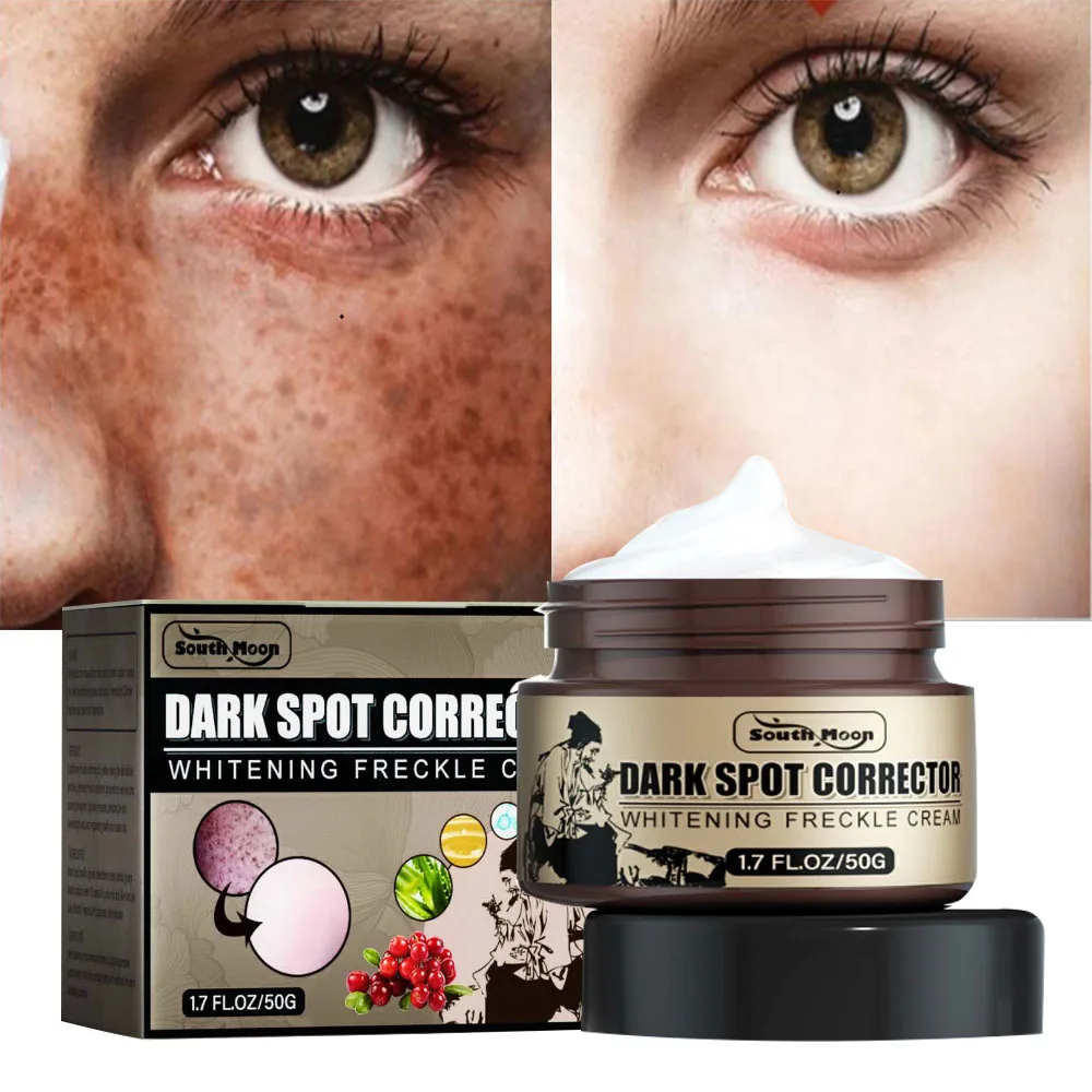 Arbutin Whitening Freckle Face Cream Remove Dark Spots Fade Melasma Melanin Shrink Pores Moisturizing Brighten Beauty Skin Care
Arbutin Whitening Freckle Face Cream Remove Dark Spots Fade Melasma Melanin Shrink Pores Moisturizing Brighten Beauty Skin Care