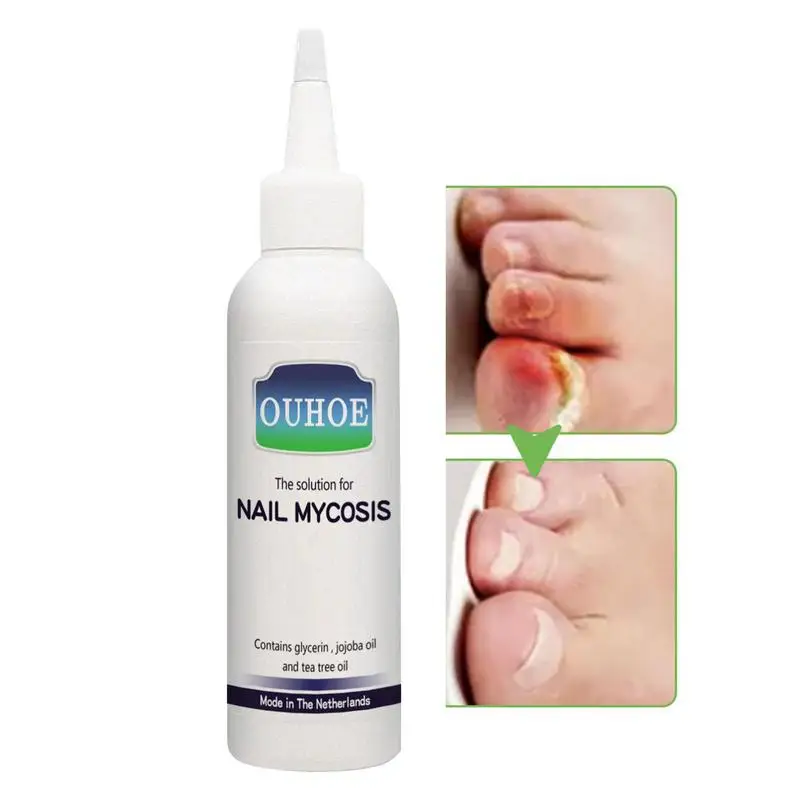Nail Cuticle Oil 75ml Soft Peeling Nails Oil Manicure Nail Care Product Soft Peeling Nails Oil Thin Damaged Nails Treatments
Nail Cuticle Oil 75ml Soft Peeling Nails Oil Manicure Nail Care Product Soft Peeling Nails Oil Thin Damaged Nails Treatments