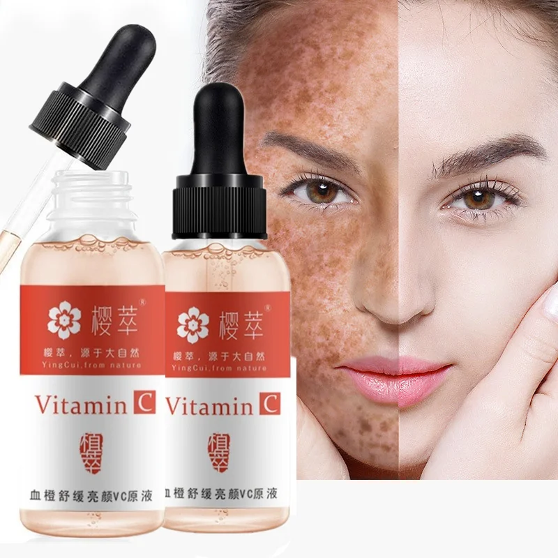 Cherry Extract Blood Orange Soothing and Brightening VC Original Whitening Effective Freckle Cream Moisturizing Essence 35ml
Cherry Extract Blood Orange Soothing and Brightening VC Original Whitening Effective Freckle Cream Moisturizing Essence 35ml