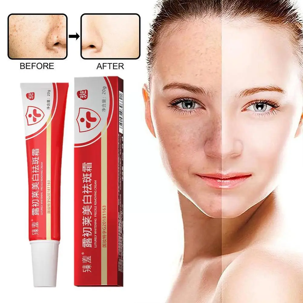 Freckle Whitening Cream Black Dots Melasma Remover Pigmentation Lighten Korean Care Anti Brown Products Stain Moisturizing K3T0
Freckle Whitening Cream Black Dots Melasma Remover Pigmentation Lighten Korean Care Anti Brown Products Stain Moisturizing K3T0