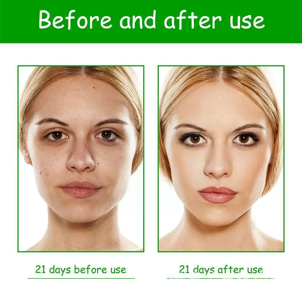 Green Tea Facial Deep Cleansing Mud Mask Moisturizing Care Facial Remover Control Blackhead Skin Oil Cleansing Mask Pore Cl Y0Q9
Green Tea Facial Deep Cleansing Mud Mask Moisturizing Care Facial Remover Control Blackhead Skin Oil Cleansing Mask Pore Cl Y0Q9