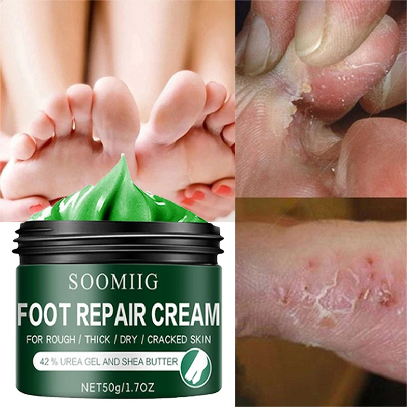 Effective Anti-Drying Crack Foot Cream Remove Hand Feet Dead Skin Heel Cracked Repair Serum Moisturizing Skincare Products 50g
Effective Anti-Drying Crack Foot Cream Remove Hand Feet Dead Skin Heel Cracked Repair Serum Moisturizing Skincare Products 50g