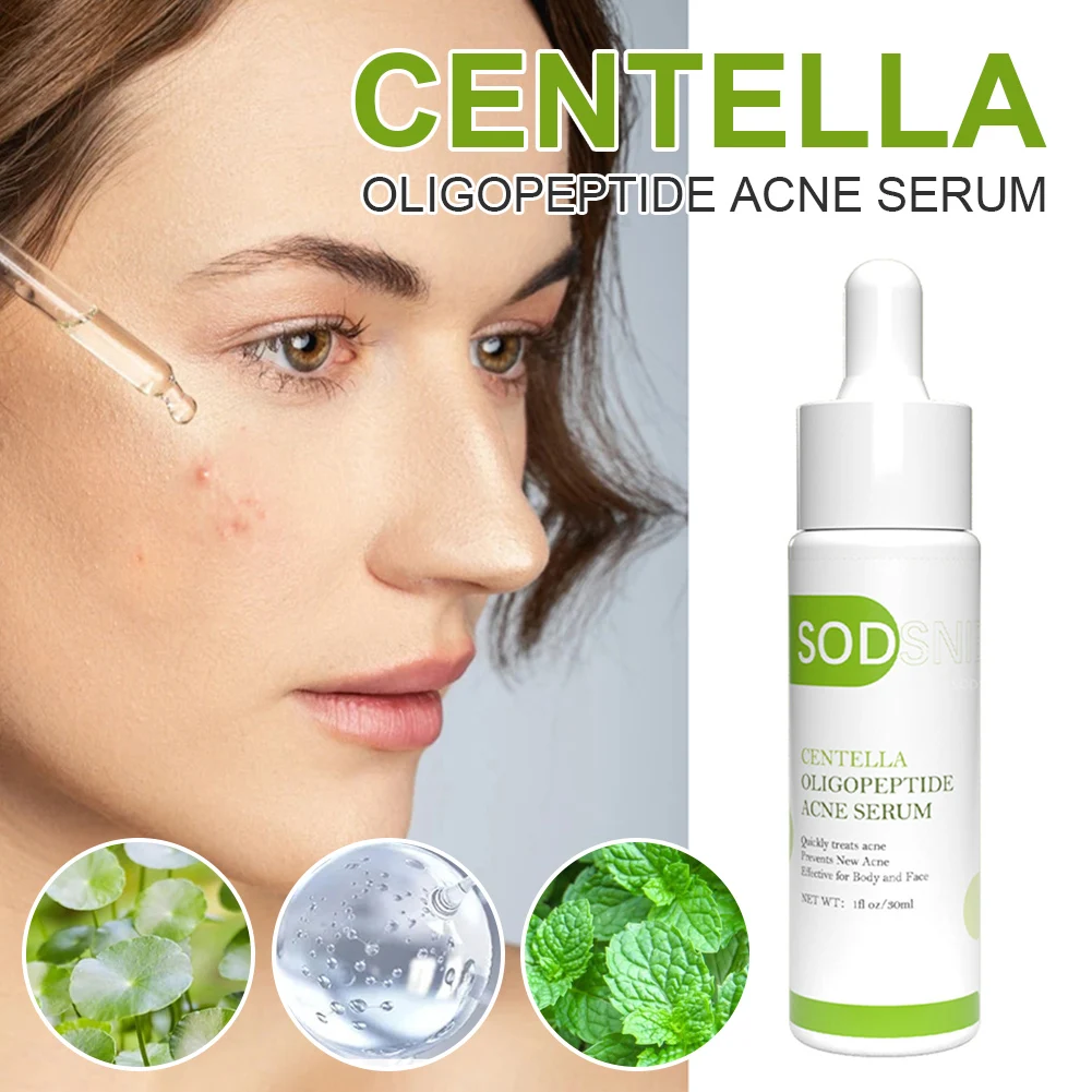 30ml Centella Oligopeptide Acne Serum Remove Acne Lighten Acne Marks Relieve Redness Pimples Balance Oil Secretion Facial Care
30ml Centella Oligopeptide Acne Serum Remove Acne Lighten Acne Marks Relieve Redness Pimples Balance Oil Secretion Facial Care