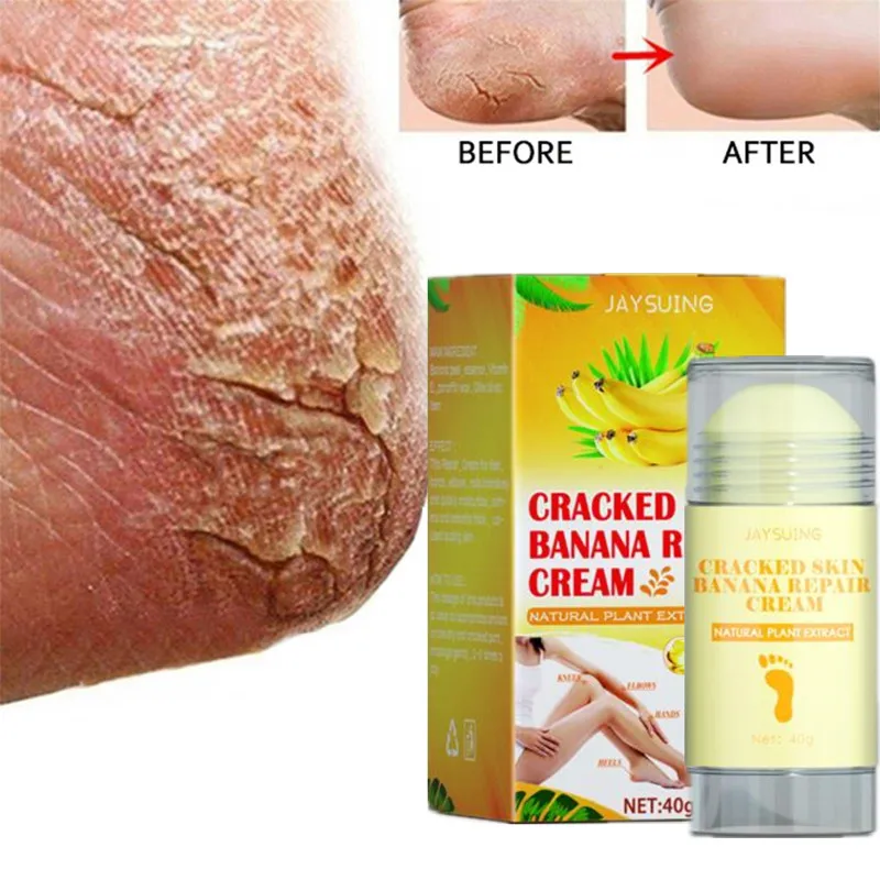 40g Oil Anti-Drying Crack Foot Cream Heel Cracked Repair Cream Removal Dead Skin Hand Feet Care for Family
40g Oil Anti-Drying Crack Foot Cream Heel Cracked Repair Cream Removal Dead Skin Hand Feet Care for Family