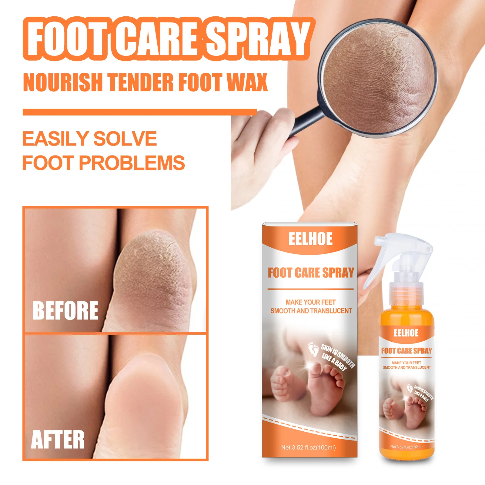 Foot Exfoliating Spray Natural Orange Spray Pedicure Hand Dead Skin Exfoliating Mask Whitening Baby Foot Care
Foot Exfoliating Spray Natural Orange Spray Pedicure Hand Dead Skin Exfoliating Mask Whitening Baby Foot Care