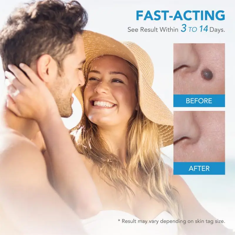 1~5PCS IN 1 Auto Skin Tag Remover Kit Micro Skin Tag Removal Device Adult Mole Stain Wart Remover Face Care Beauty Tools
1~5PCS IN 1 Auto Skin Tag Remover Kit Micro Skin Tag Removal Device Adult Mole Stain Wart Remover Face Care Beauty Tools