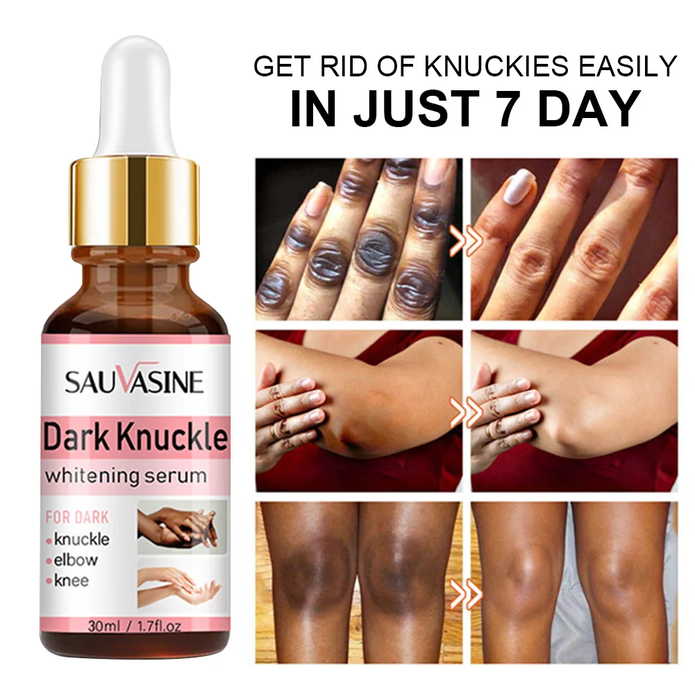 30ml Dark Knuckle Whitening Serum Lighten Melanin Reduce Knee Elbow Dullness Skin Brightening Bleaching Essence Skin Care
30ml Dark Knuckle Whitening Serum Lighten Melanin Reduce Knee Elbow Dullness Skin Brightening Bleaching Essence Skin Care