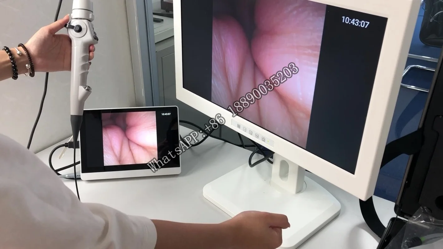 LHBF China Endoscopios Bronchoscope HD Type Medical Endoscope Rhinolaryngoscope Portable video
LHBF China Endoscopios Bronchoscope HD Type Medical Endoscope Rhinolaryngoscope Portable video