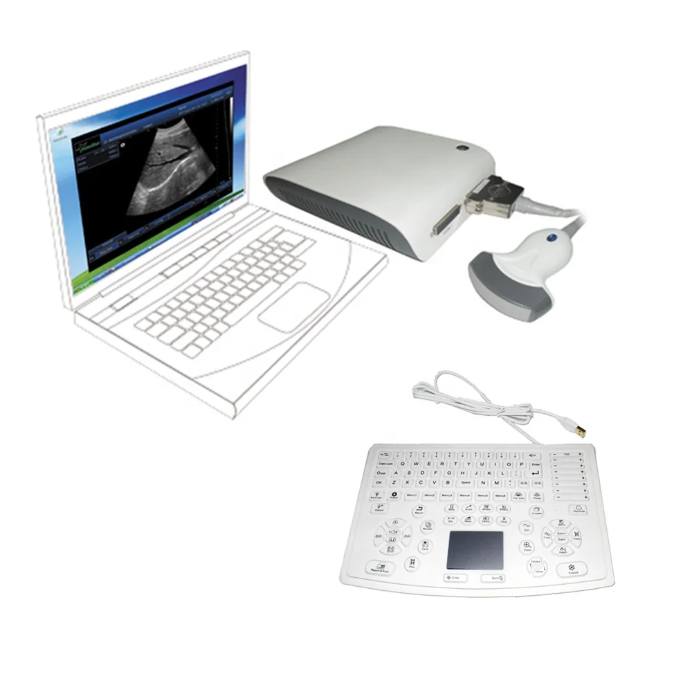 Free shipping Human or animal 3D B/W ultrasound box scanner machine with ultrasound keyboard Ubox
Free shipping Human or animal 3D B/W ultrasound box scanner machine with ultrasound keyboard Ubox
