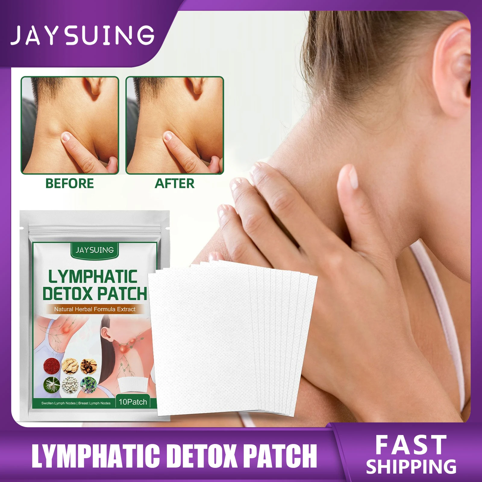 Lymphatic Drainage Detox Patches Relieve Lymph Nodes Swell Pain Treatment Armpit Neck Node Swollen Anti-swelling Herbal Plaster
Lymphatic Drainage Detox Patches Relieve Lymph Nodes Swell Pain Treatment Armpit Neck Node Swollen Anti-swelling Herbal Plaster