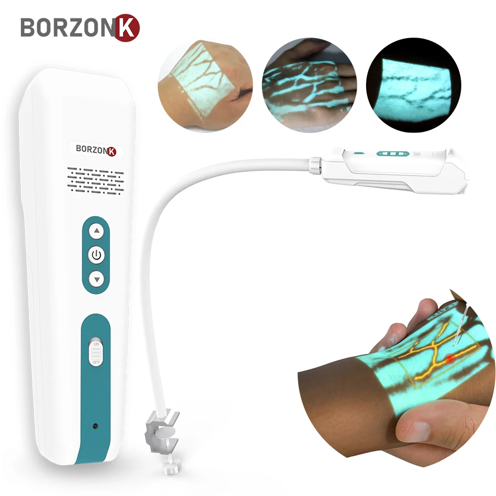 Medical infrared portable Vein Finder VF20 with fixed stand Vein blood scanner detector locator Finder 
Medical infrared portable Vein Finder VF20 with fixed stand Vein blood scanner detector locator Finder