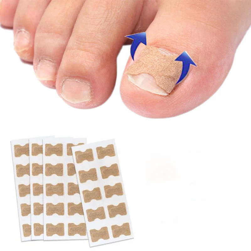 Nail Correction Stickers Ingrown Toenail Corrector Patches Paronychia Treatment Recover Corrector Pedicure Tools
Nail Correction Stickers Ingrown Toenail Corrector Patches Paronychia Treatment Recover Corrector Pedicure Tools