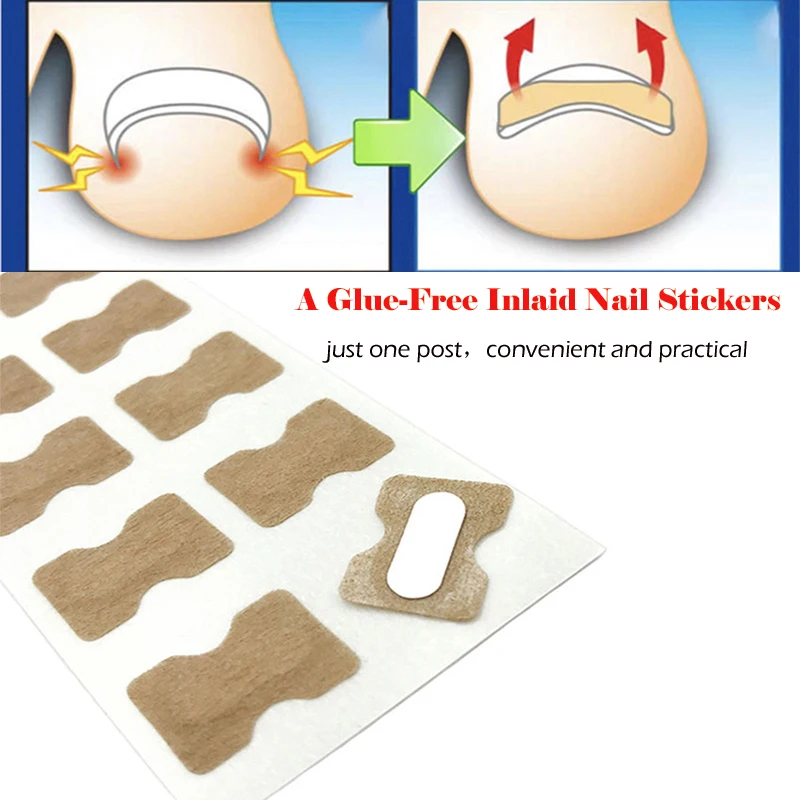 Ingrown Toenail Corrector Stickers Paronychia Treatment Pedicure Toe Nail Care Corrector Patch Correction Stickers 10-50Pcs
Ingrown Toenail Corrector Stickers Paronychia Treatment Pedicure Toe Nail Care Corrector Patch Correction Stickers 10-50Pcs