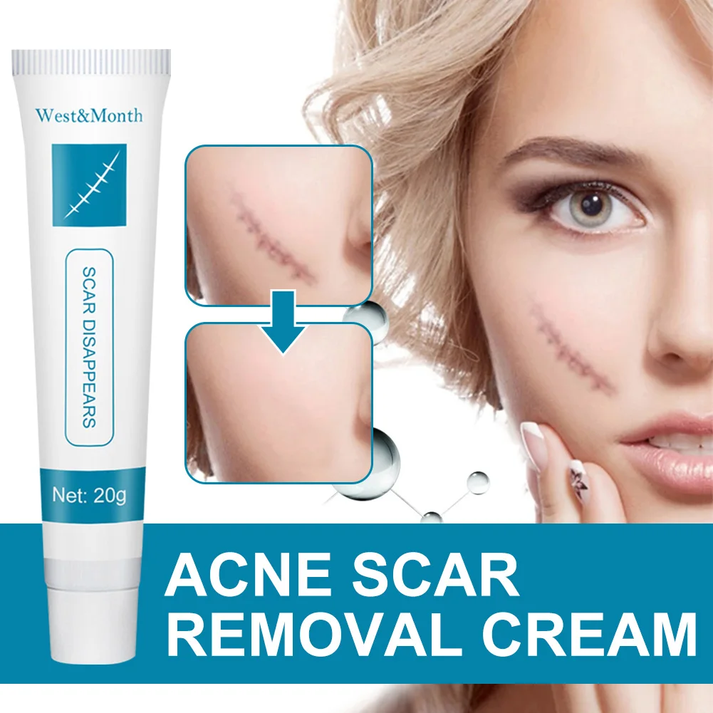 20g Acne Scar Removal Cream Pimples Stretch Marks Face Gel Remove Acne Smoothing Whitening Moisturizing Body Skin Care Aichun
20g Acne Scar Removal Cream Pimples Stretch Marks Face Gel Remove Acne Smoothing Whitening Moisturizing Body Skin Care Aichun