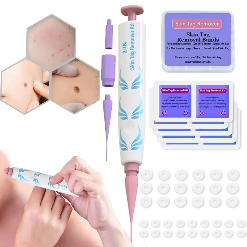 Skin Tags Remover Pen Painless Wart Remover Pen Tags Removal Tool Set For 2-8mm Skin Tags Easy Application In Minutes Safe And
Skin Tags Remover Pen Painless Wart Remover Pen Tags Removal Tool Set For 2-8mm Skin Tags Easy Application In Minutes Safe And