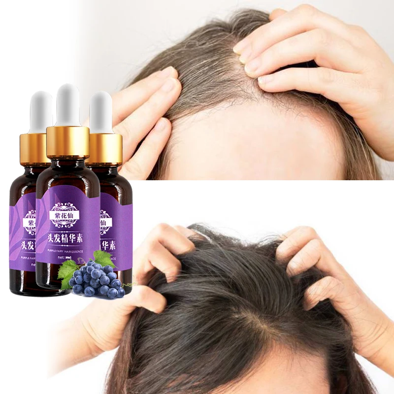 

3 шт., масло виноградных косточек, волосы для быстрого роста, эссенция для выпадения волос, продукт для роста волос, жидкость, предотвращающая лечение, повреждение, уход за волосами