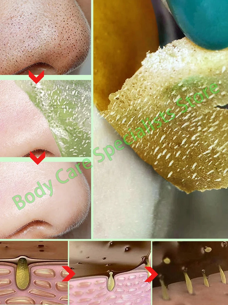 Nose Blackhead Remover Mask Deep Cleansing Skin Care Shrink Pore Acne Treatment Mask Nose Black dots Pore Clean
Nose Blackhead Remover Mask Deep Cleansing Skin Care Shrink Pore Acne Treatment Mask Nose Black dots Pore Clean