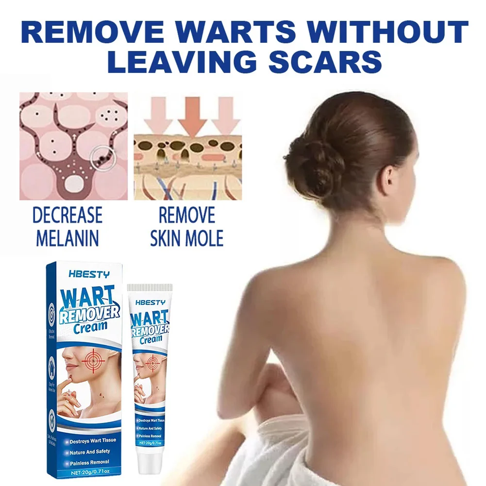 Skin Tag Remover Cream Painless Mole Warts Corn Remover Fast Acting Skin Tag Treatment Cream For All Skins Anti-wart cream
Skin Tag Remover Cream Painless Mole Warts Corn Remover Fast Acting Skin Tag Treatment Cream For All Skins Anti-wart cream