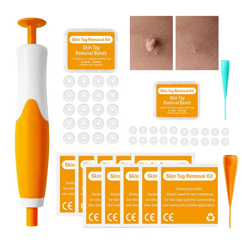 Skin Tags Remover Auto Skin Tags Removal Kit 2 In 1 Easy To Use Safe And Painless Skin Tags Remover For Small To Large Tags For
Skin Tags Remover Auto Skin Tags Removal Kit 2 In 1 Easy To Use Safe And Painless Skin Tags Remover For Small To Large Tags For