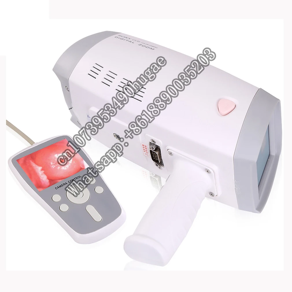 Medical portable handheld gynecology colposcopy system digital women gynecology electronic video colposcope
Medical portable handheld gynecology colposcopy system digital women gynecology electronic video colposcope