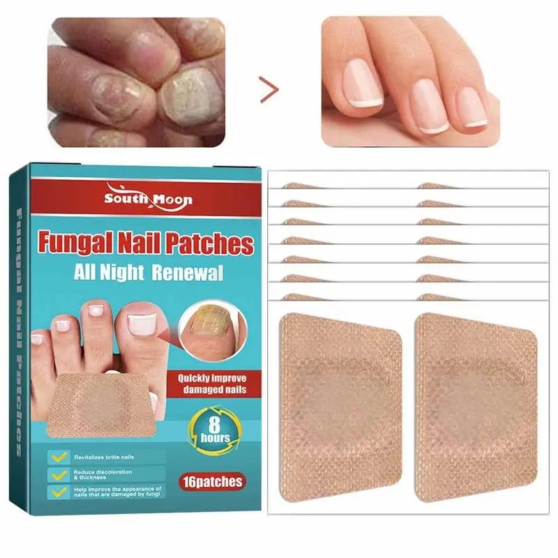 Nail Care Night Patches Soft Toenail Correction Patches Thickening Nail Repair Stickers Easy To Use Toenail Brace Pedicure Tool
Nail Care Night Patches Soft Toenail Correction Patches Thickening Nail Repair Stickers Easy To Use Toenail Brace Pedicure Tool