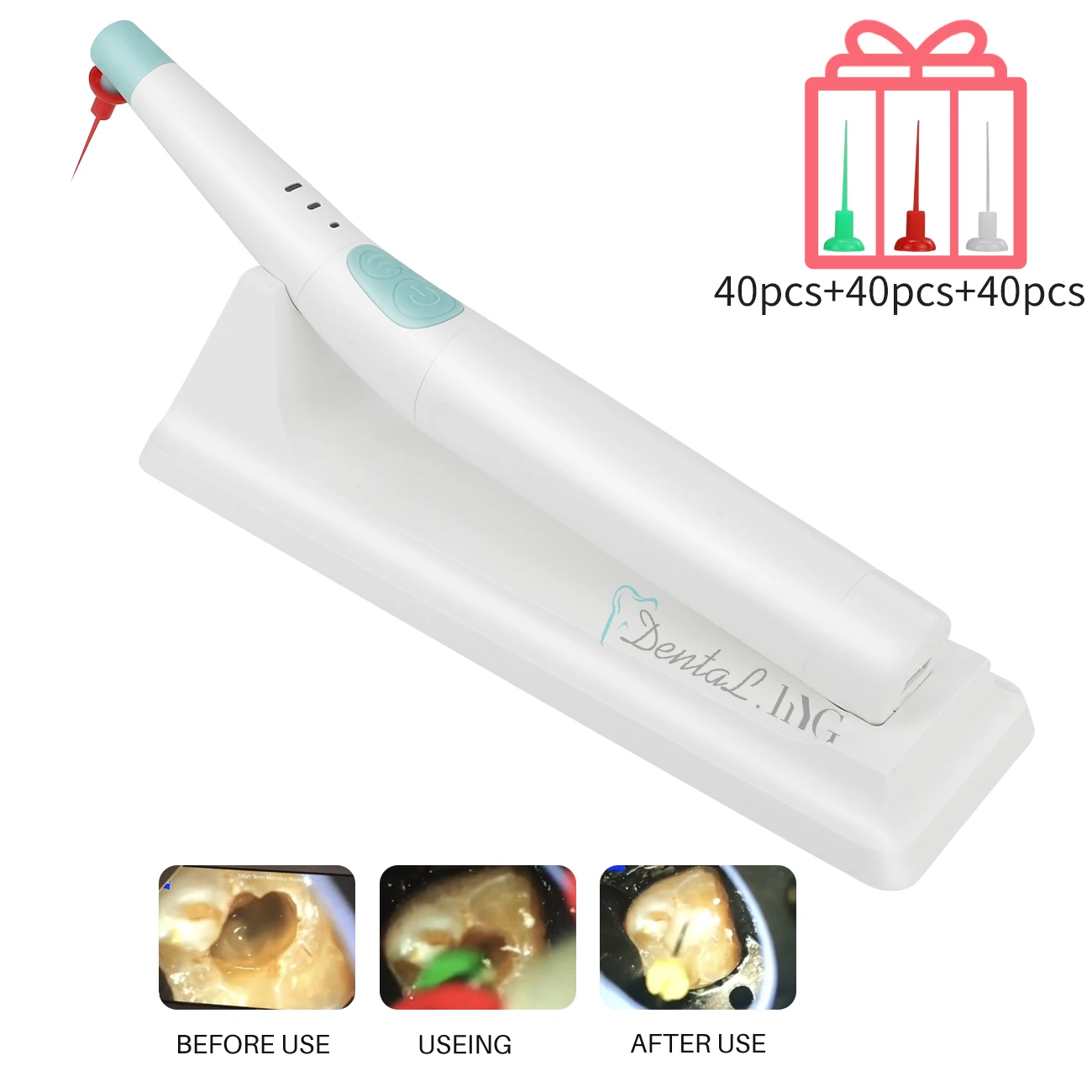 Cordless Dental Teeth Cleaning Equipment Endo Activator 3-speed Sonic Motor Handpiece 120 Tips For Root Canal
Cordless Dental Teeth Cleaning Equipment Endo Activator 3-speed Sonic Motor Handpiece 120 Tips For Root Canal