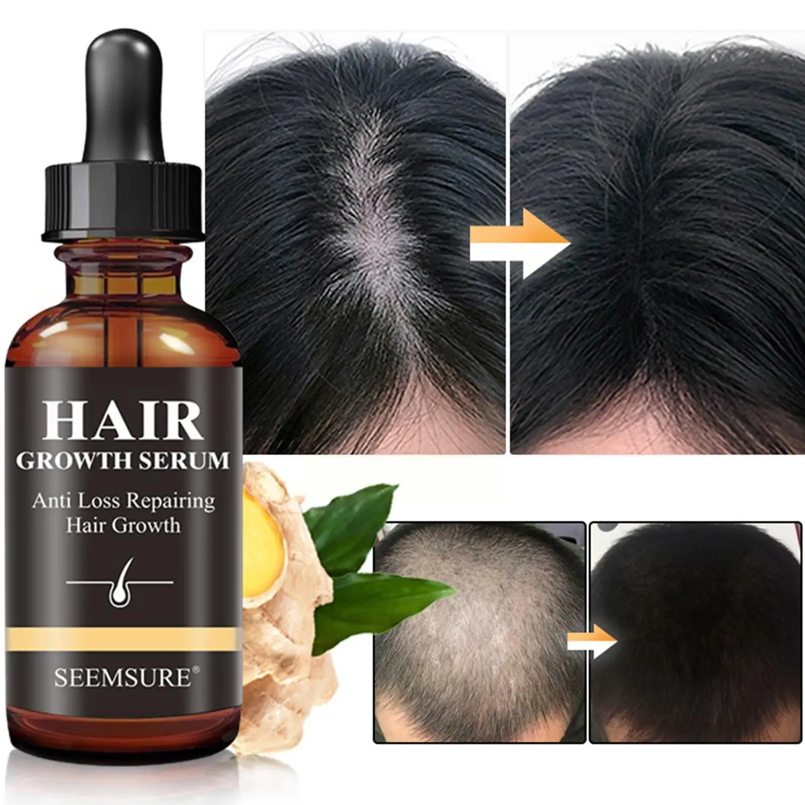 Ginger Hair Growth Products Fast Growing Hair Essential Oil Beauty Hair Care Prevent Hair Loss Oil Scalp Treatment For Men J5b5
Ginger Hair Growth Products Fast Growing Hair Essential Oil Beauty Hair Care Prevent Hair Loss Oil Scalp Treatment For Men J5b5