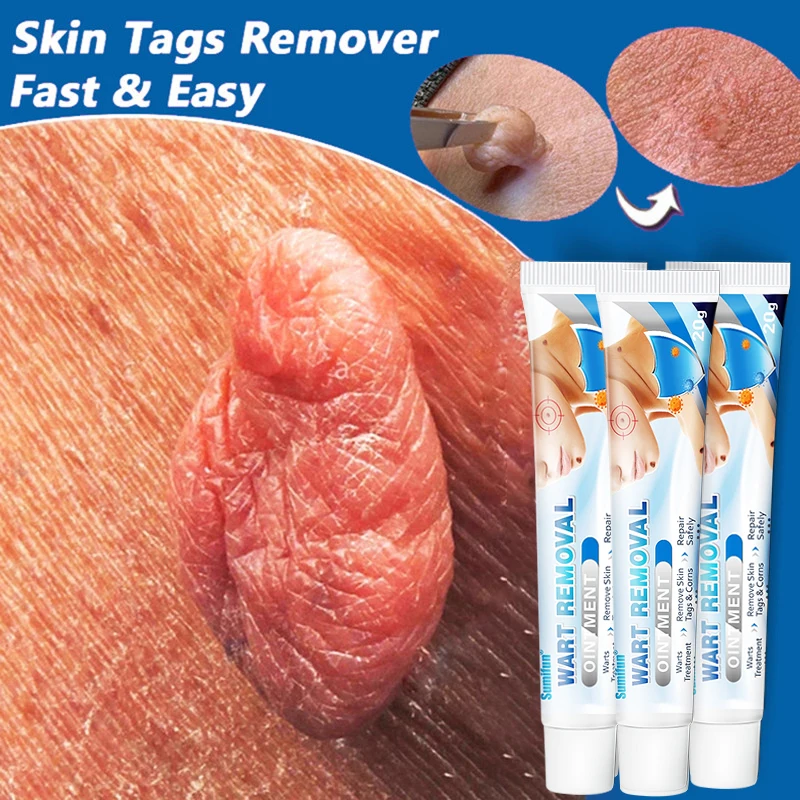 1-3Pcs Skin Tag Remover Cream Painless Mole Skin Dark Spot Warts Remover Serum Freckle Face Wart Tag Treatment Removal Plaster
1-3Pcs Skin Tag Remover Cream Painless Mole Skin Dark Spot Warts Remover Serum Freckle Face Wart Tag Treatment Removal Plaster