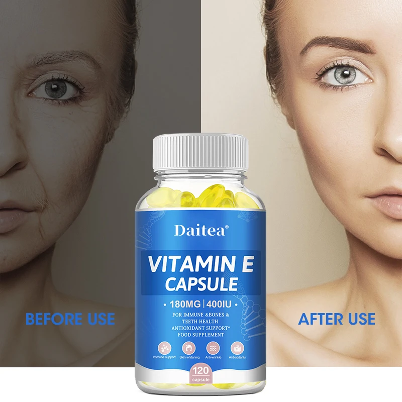 Vitamin E supplement helps improve memory, anti-aging, relieve dark circles, melanin, improve skin texture and skin health
Vitamin E supplement helps improve memory, anti-aging, relieve dark circles, melanin, improve skin texture and skin health