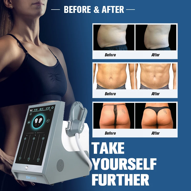 2022 DLS EMSLIM Nova Aesthetics zero Slimming Machine RF 4 Handles Body Sculpt muscle emszero NEO With RF Fat Burning gym use
2022 DLS EMSLIM Nova Aesthetics zero Slimming Machine RF 4 Handles Body Sculpt muscle emszero NEO With RF Fat Burning gym use