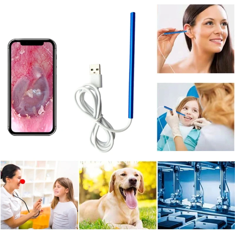 Ear Wax Removal Tool Ear Cleaner with Camera Earwax Remover Otoscope Ear Cleaning Endoscope Wireless Ear Cleaning Kit
Ear Wax Removal Tool Ear Cleaner with Camera Earwax Remover Otoscope Ear Cleaning Endoscope Wireless Ear Cleaning Kit