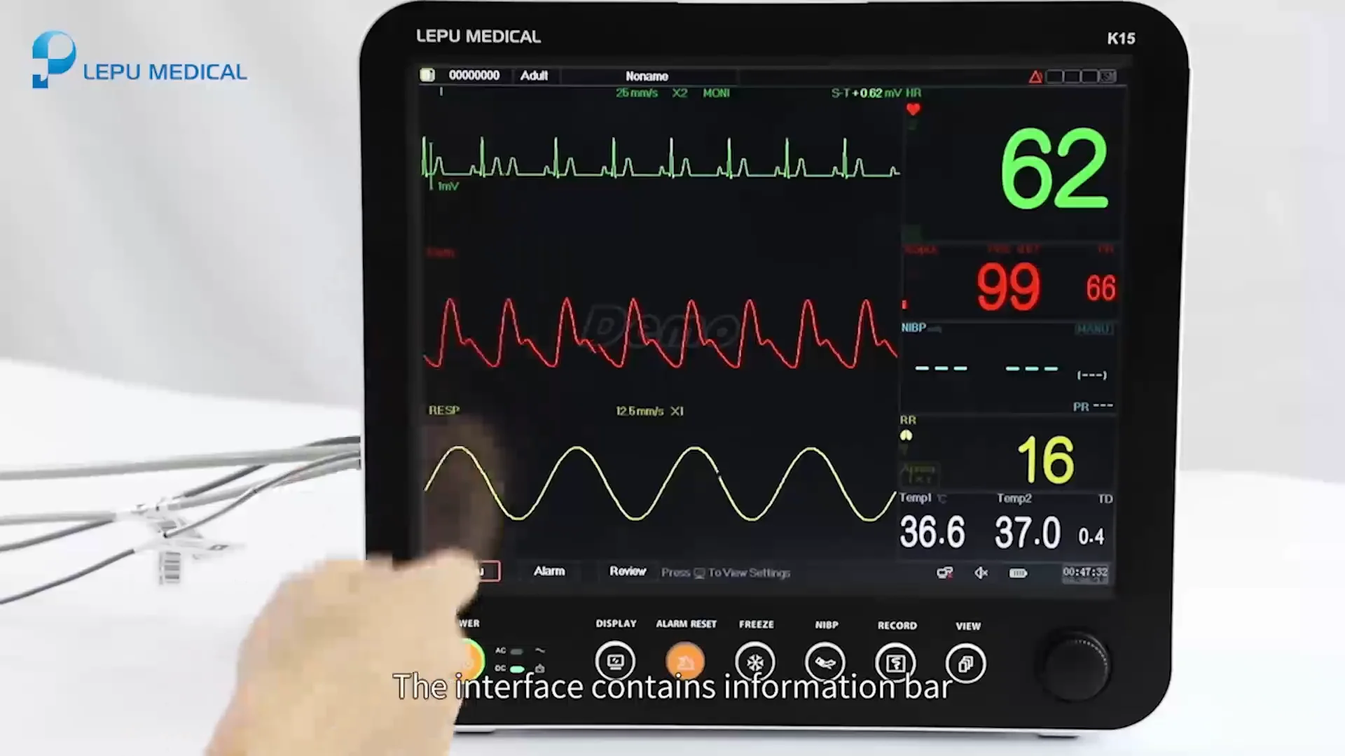 Creative touch screen hospital ICU clinical computing multi-function multi-parameter patient monitor
Creative touch screen hospital ICU clinical computing multi-function multi-parameter patient monitor