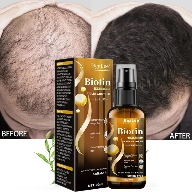 Продукты для роста волос iBeaLee Biotin, быстрорастущее эфирное масло для волос, уход за волосами, предотвращение выпадения волос, лечение кожи головы для мужчин, женщин и мужчин
Продукты для роста волос iBeaLee Biotin, быстрорастущее эфирное масло для волос, уход за волосами, предотвращение выпадения волос, лечение кожи головы для мужчин, женщин и мужчин