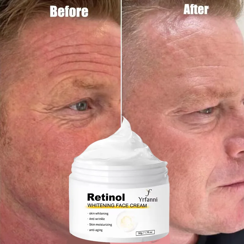Retinol Wrinkles Removal Cream Firming Lifting Fade Fine Lines Vitamin E Anti-Aging Brighten Moisturizing Smooth Face Skin Care
Retinol Wrinkles Removal Cream Firming Lifting Fade Fine Lines Vitamin E Anti-Aging Brighten Moisturizing Smooth Face Skin Care
