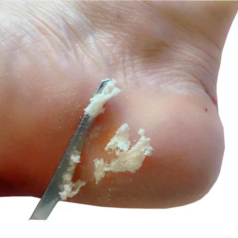 Manicure Pedicure Tools Toe Nail Shaver Feet Pedicure Knife Kit Foot Callus Rasp File Dead Skin Remover Foot Care Tools
Manicure Pedicure Tools Toe Nail Shaver Feet Pedicure Knife Kit Foot Callus Rasp File Dead Skin Remover Foot Care Tools